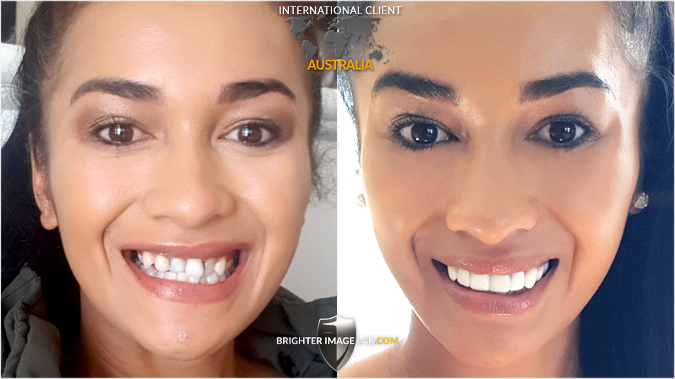 AU-NicoleTipene-WEB-BA