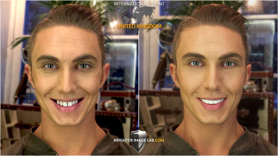 UK-JorgeMattey-WEB-BA