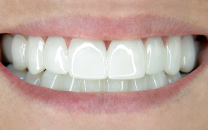 Slider-Heather-After